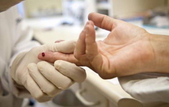 Remédio que previne contaminação pelo vírus HIV será oferecido pelo SUS este mês Remédio que previne contaminação pelo vírus HIV será oferecido pelo SUS este mês