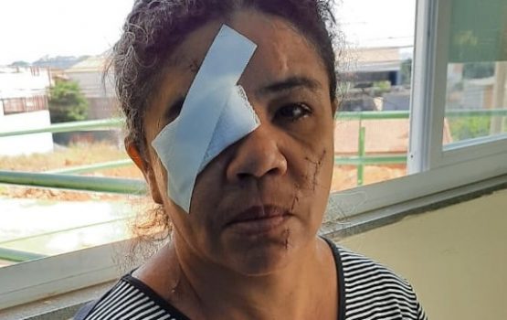Em Parauapebas, homem vira “cavalo do cão” e esfaqueia mulher que estava louvando a Deus Em Parauapebas, homem vira “cavalo do cão” e esfaqueia mulher que estava louvando a Deus